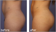 Click Here to See Patients Before & After Photos