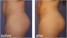 Click Here to See Patients Before & After Photos